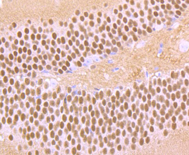 Ctip2 Rabbit mAb