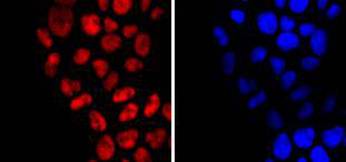 Dnmt1 Rabbit mAb