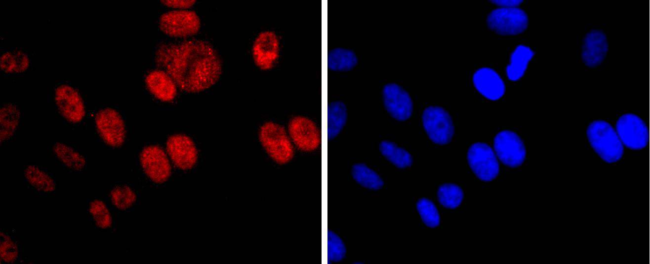 Dnmt1 Rabbit mAb