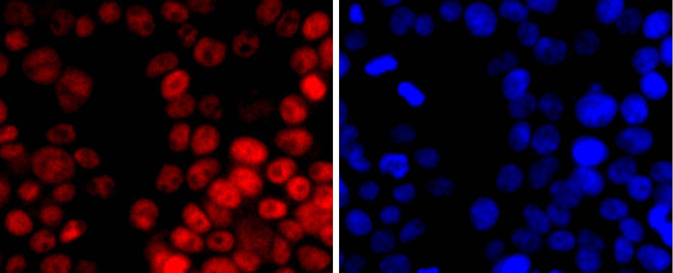 Dnmt1 Rabbit mAb