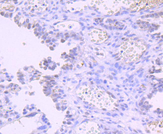 Dnmt1 Rabbit mAb