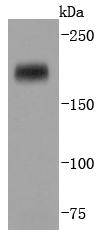 Dnmt1 Rabbit mAb