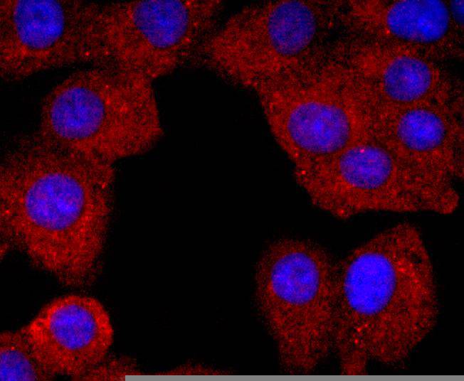 Neutrophil Elastase Rabbit mAb