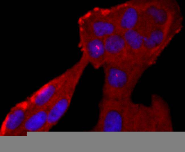 Neutrophil Elastase Rabbit mAb