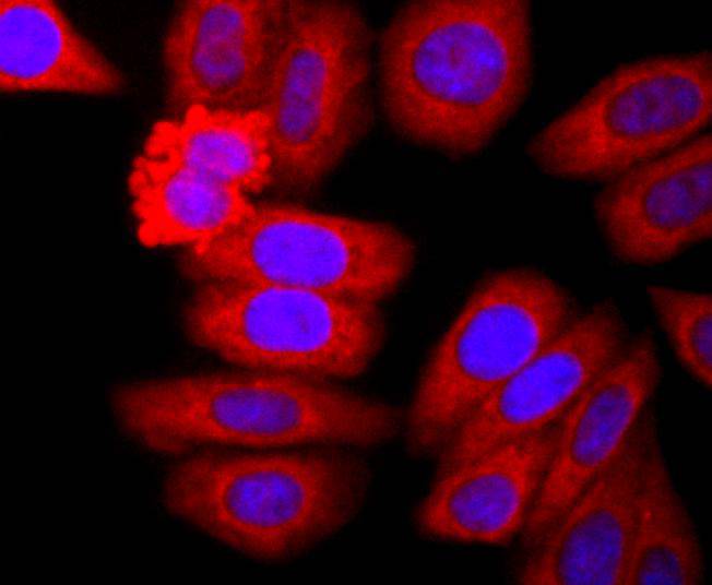 Neutrophil Elastase Rabbit mAb