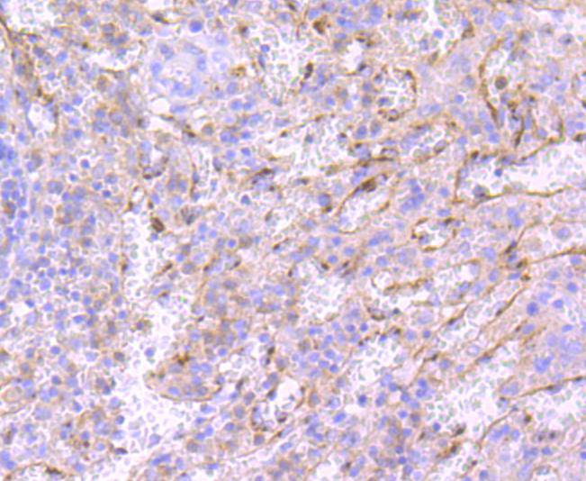 Neutrophil Elastase Rabbit mAb