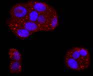 ASPP2 Rabbit mAb