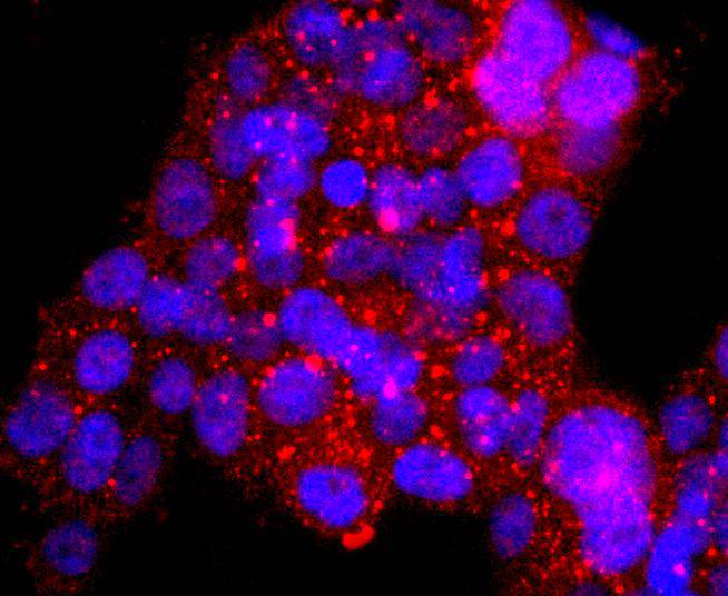 ASPP2 Rabbit mAb