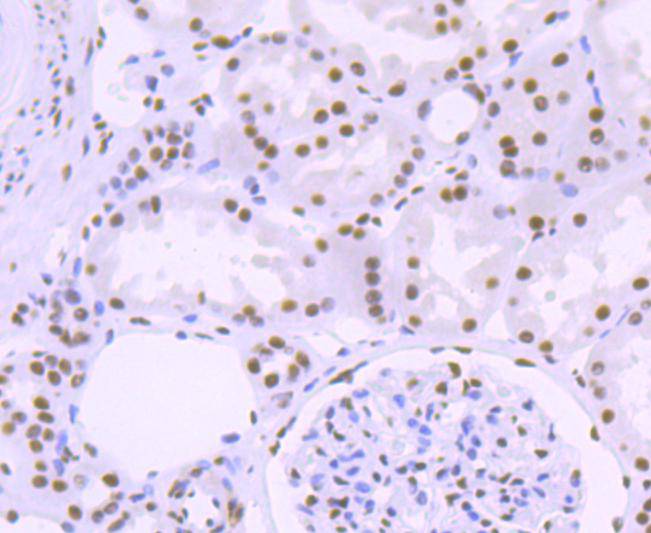 ASPP2 Rabbit mAb