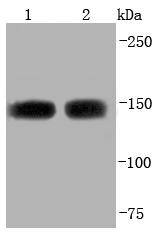 ASPP2 Rabbit mAb