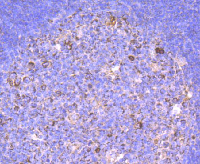 Human IgM Rabbit mAb