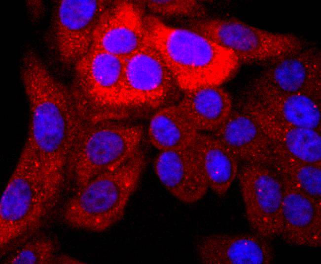 S100P Rabbit mAb