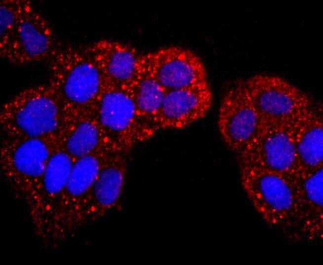 S100P Rabbit mAb