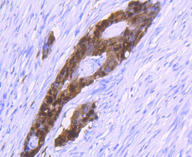 S100P Rabbit mAb