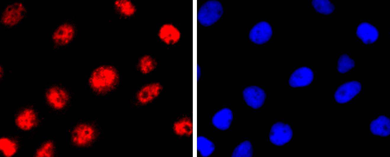 MiTF Rabbit mAb