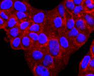 alpha 1 Antitrypsin Rabbit mAb