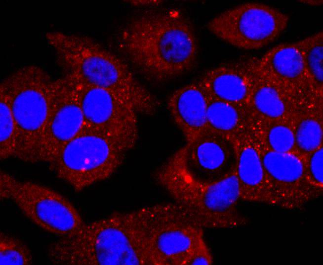 alpha 1 Antitrypsin Rabbit mAb