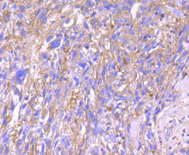 alpha 1 Antitrypsin Rabbit mAb