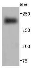 Myosin heavy chain Rabbit mAb