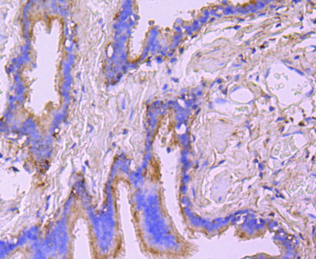 Ezrin Rabbit mAb