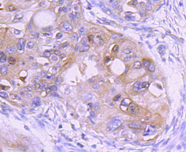 Ezrin Rabbit mAb