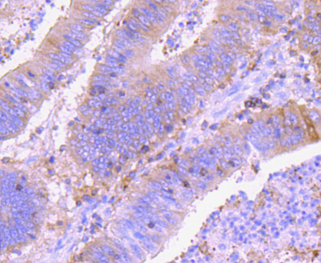 Ezrin Rabbit mAb