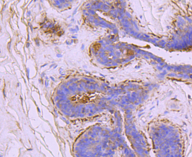 Ezrin Rabbit mAb