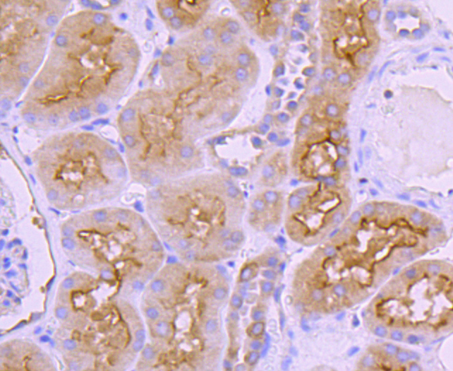 Ezrin Rabbit mAb