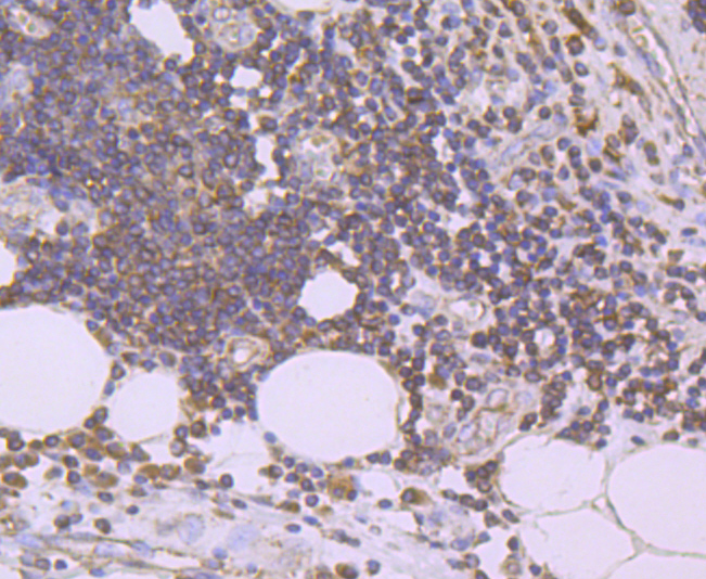 Urokinase Rabbit mAb