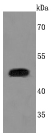 Urokinase Rabbit mAb