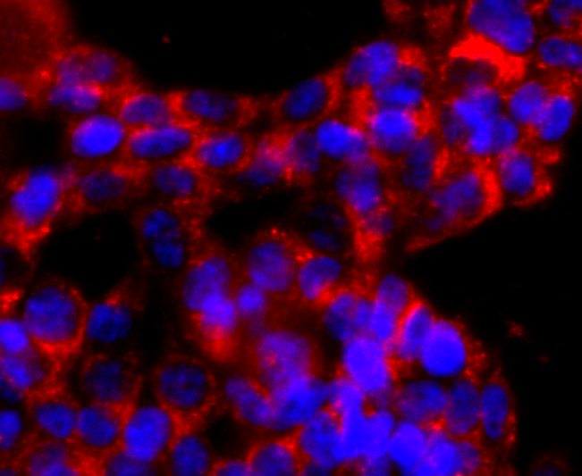 ATPB Rabbit mAb