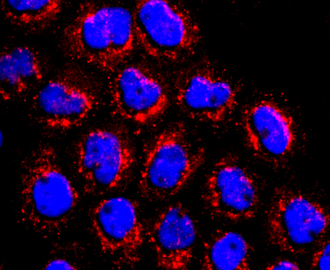 ATPB Rabbit mAb