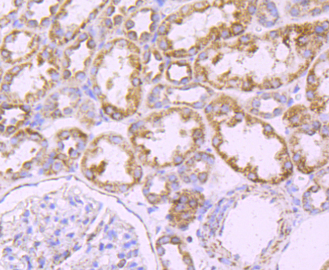 ATPB Rabbit mAb