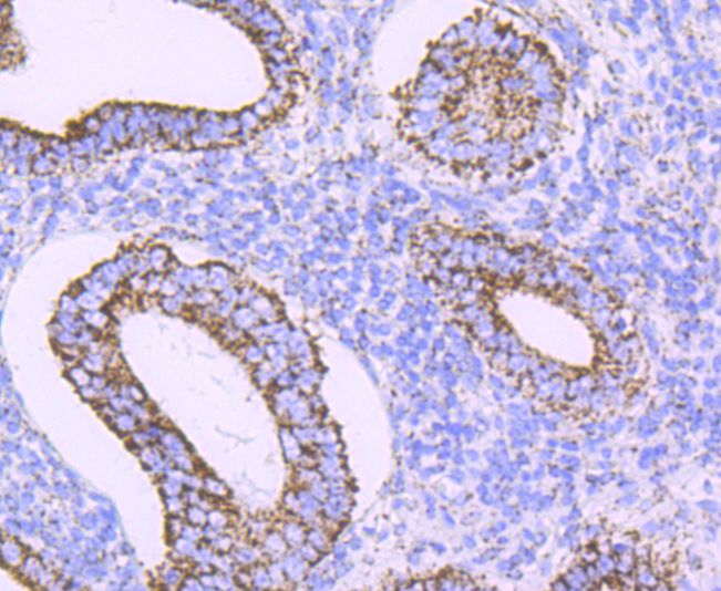 ATPB Rabbit mAb