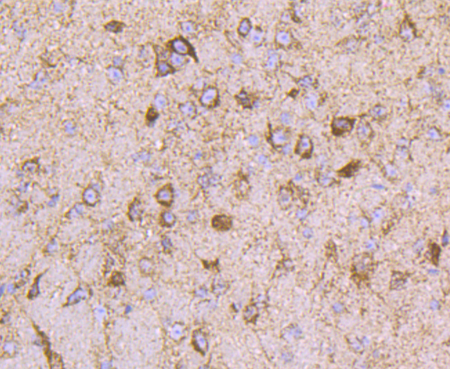 ATPB Rabbit mAb