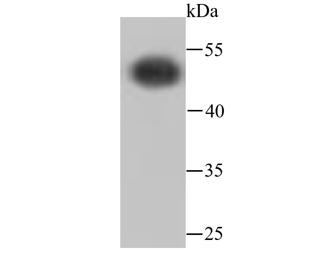 ATPB Rabbit mAb