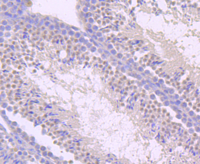 TLR5 Rabbit mAb