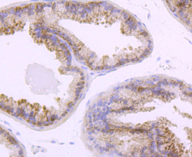 TLR5 Rabbit mAb