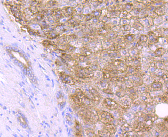 Catalase Rabbit mAb