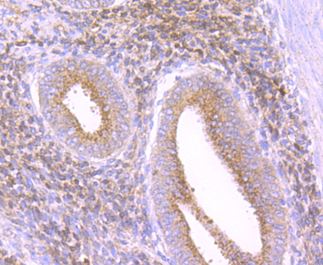 Catalase Rabbit mAb