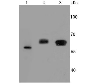 Catalase Rabbit mAb