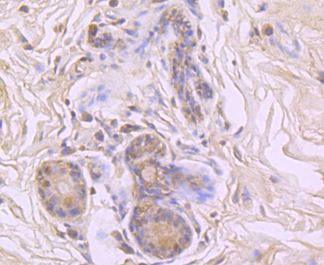 Cyclophilin A Rabbit mAb