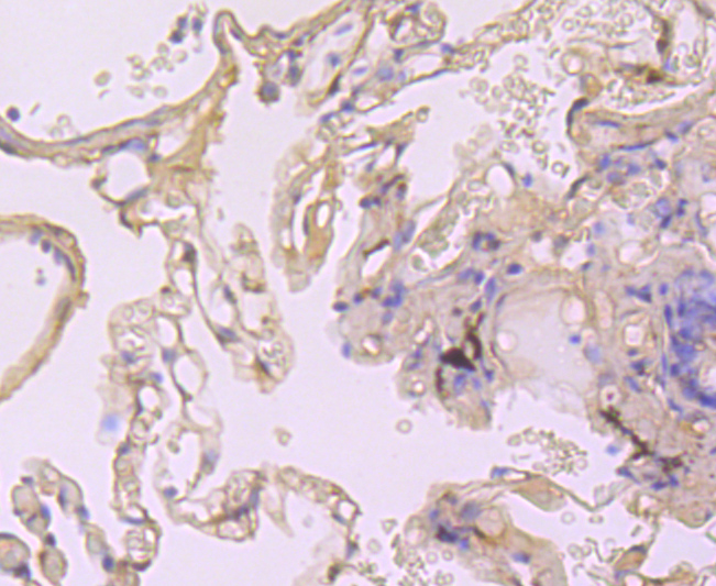 Cyclophilin A Rabbit mAb