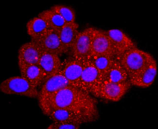 AQP1 Rabbit mAb