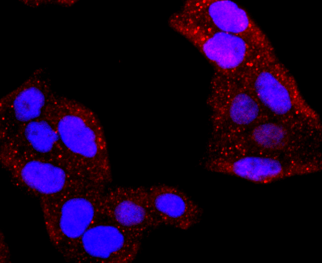 AQP1 Rabbit mAb