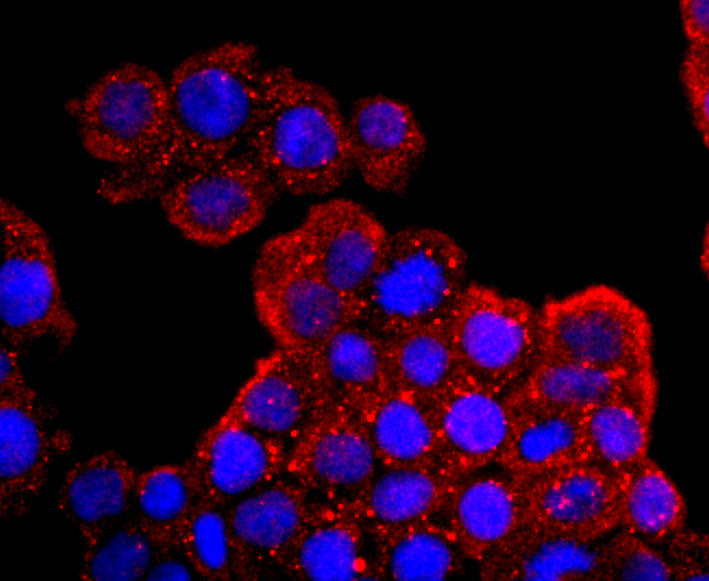 AQP1 Rabbit mAb