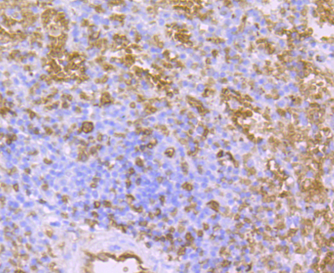 AQP1 Rabbit mAb