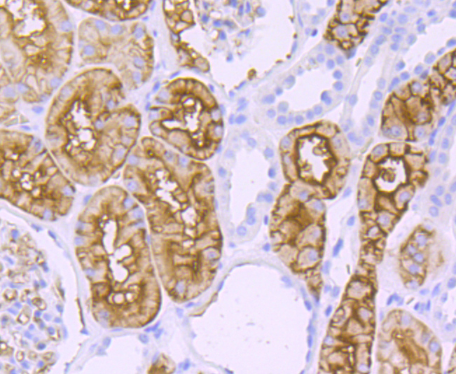 AQP1 Rabbit mAb