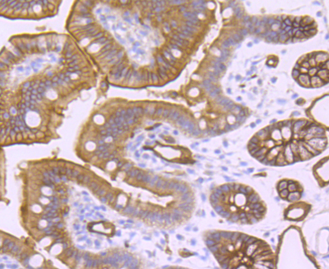 AQP1 Rabbit mAb