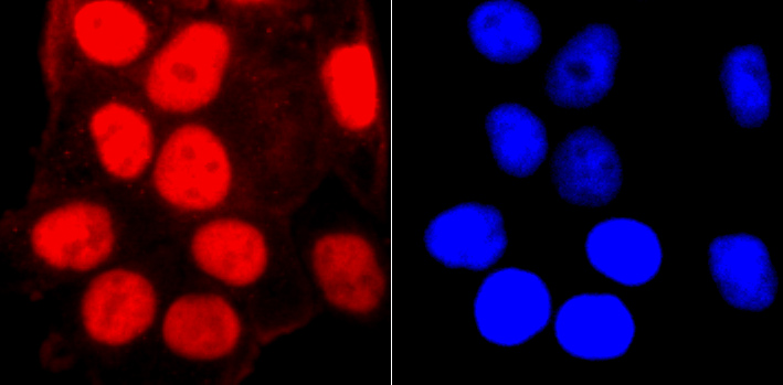 SMC3 Rabbit mAb